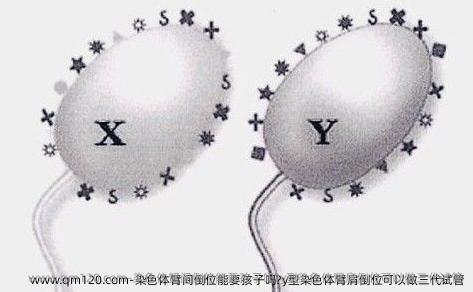 染色体臂间倒位能要孩子吗?y型染色体臂肩倒位可以做三代试管