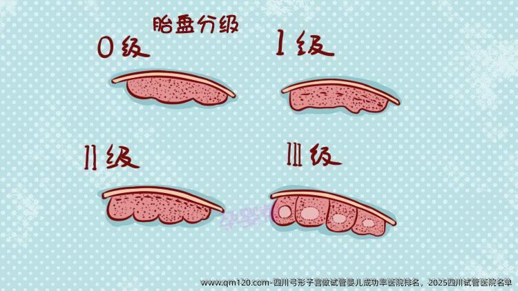 四川弓形子宫做试管婴儿成功率医院排名，2025四川试管医院名单