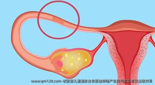 试管婴儿遭遇嵌合体<a href=
