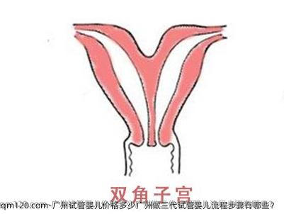 广州试管婴儿价格多少广州做三代试管婴儿流程步骤有哪些？
