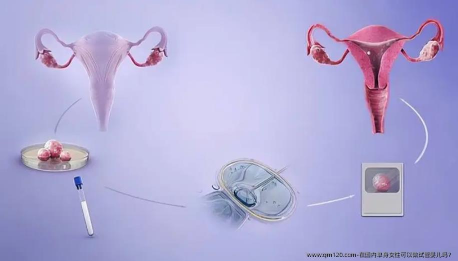 在国内单身女性可以做试管婴儿吗？