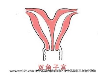 女性不孕的种种迹象？女性不孕有三大治疗原则