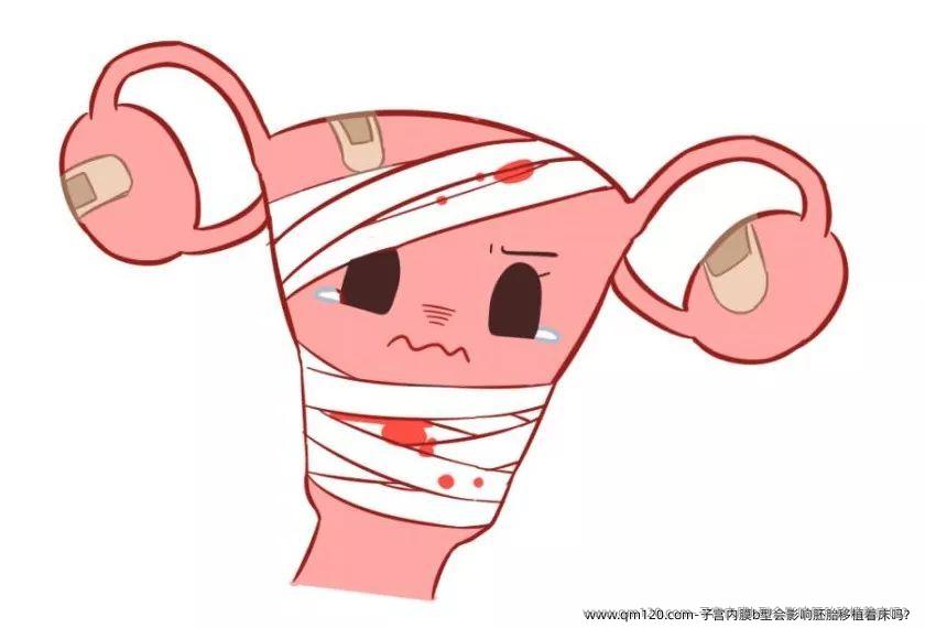 子宫内膜b型会影响胚胎移植着床吗？