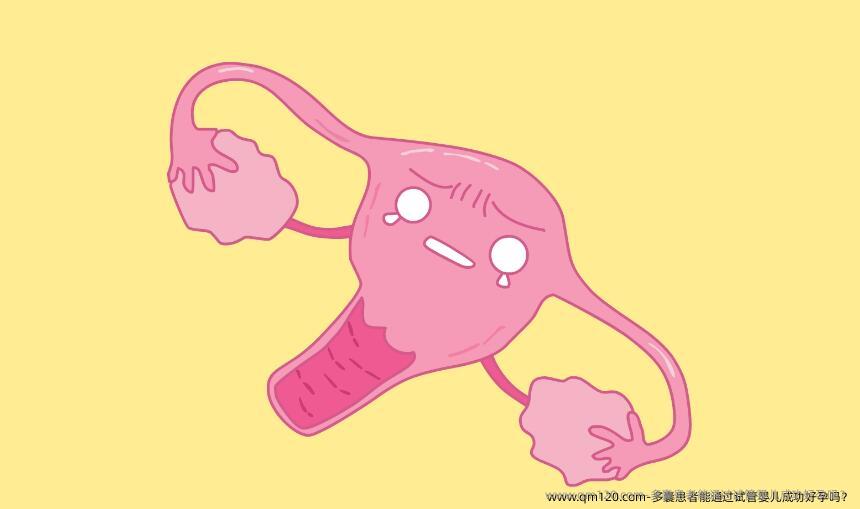 多囊患者能通过试管婴儿成功好孕吗？