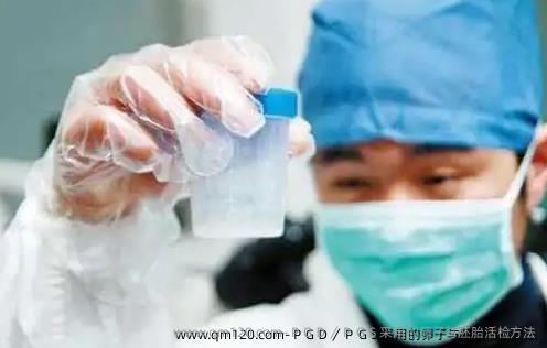 ＰＧＤ／ＰＧＳ采用的卵子与胚胎活检方法