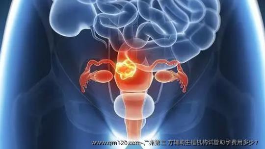 广州第三 方辅助生殖机构试管助孕费用多少？