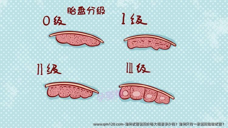 漳州试管医院价格大概要多少钱？漳州只有一家医院能做试管？