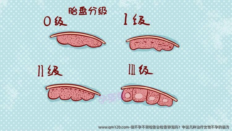 做不孕不育检查会检查卵泡吗？中医几种治疗女性不孕的偏方