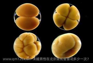 未婚男性在北京做试管要花多少一次？