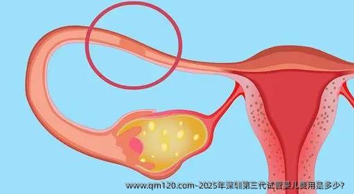 2025年深圳第三代试管婴儿费用是多少？