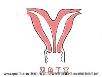 老婆乙肝大三阳病毒量7的8次方可以做试管婴儿吗？