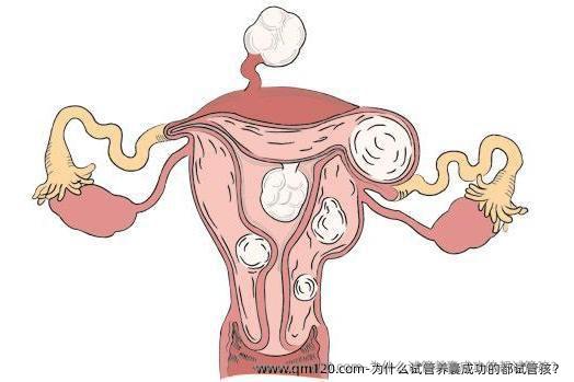 为什么试管养囊成功的都试管孩？