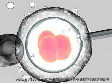 广州三甲医院试管价格正规花销在这些地方