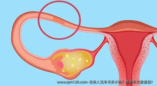 兰州人流手术多少钱？哪家手术最便宜？