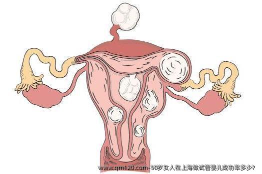 50岁女人在上海做试管婴儿成功率多少？