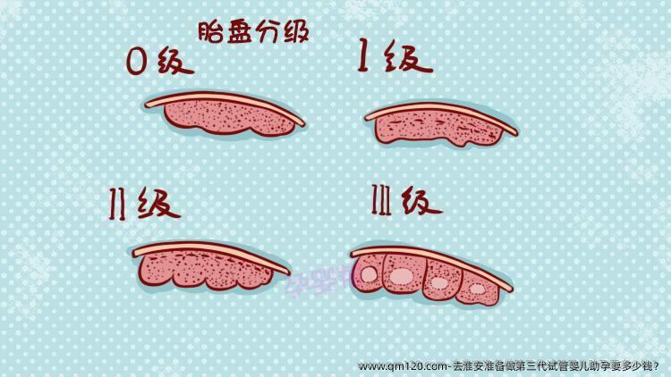 去淮安准备做第三代试管婴儿助孕要多少钱？