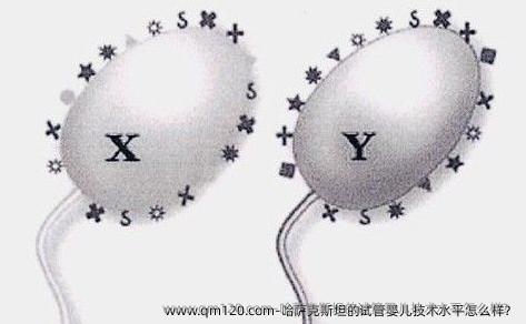 哈萨克斯坦的试管婴儿技术水平怎么样？