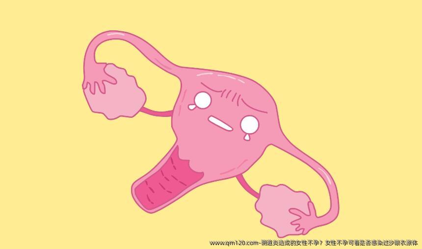 阴道炎造成的女性不孕？女性不孕可看是否感染过沙眼衣原体