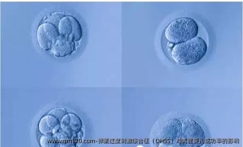 卵巢过度刺激综合征（OHSS）对试管婴儿成功率的影响