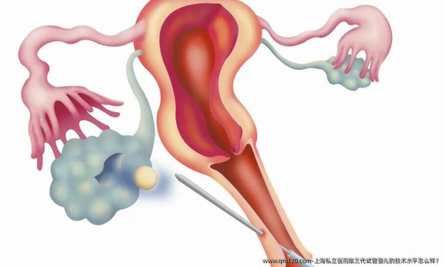 上海私立医院做三代试管婴儿的技术水平怎么样？