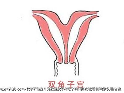 女子产后3个月发现又怀孕2个月!?两次试管间隔多久最合适