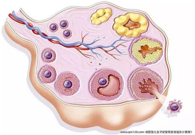 试管婴儿生子试管需要准备多少费用？