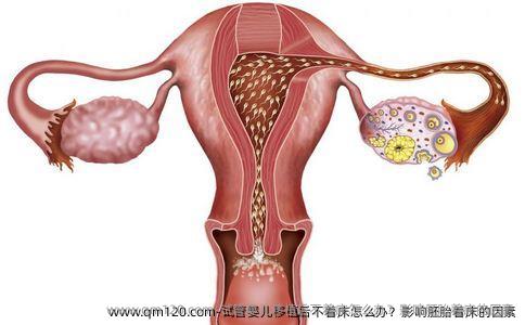 试管婴儿移植后不着床怎么办？影响胚胎着床的因素