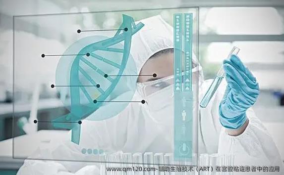 辅助生殖技术（ART）在宫腔粘连患者中的应用