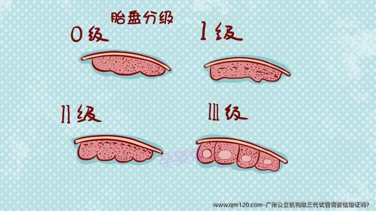 广州公立机构做三代试管需要结婚证吗？