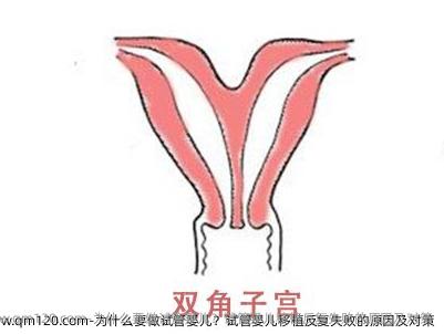 为什么要做试管婴儿？试管婴儿移植反复失败的原因及对策