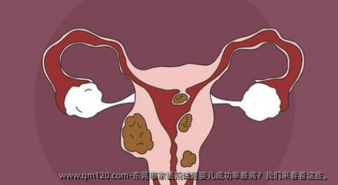东莞哪家医院试管婴儿**？我们来看看这些。