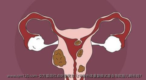 女方基因位点突变男方12号染色体重复做试管会导致胎儿畸形吗？