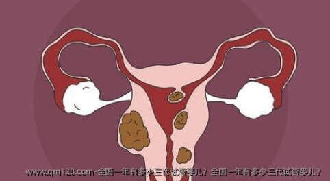 国内一年有多少三代试管婴儿？国内一年有多少三代试管婴儿？