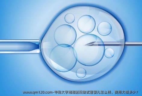 中南大学湘雅医院做试管婴儿怎么样，费用大概多少？