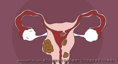第三代试管生孩子多少费用？三代试管生孩子12万够吗？