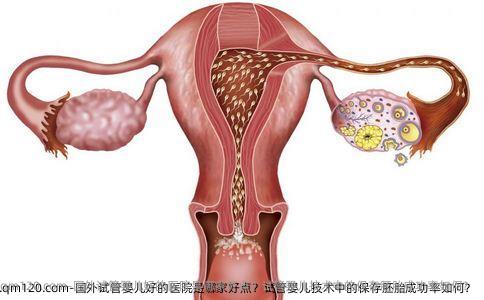 国外试管婴儿好的医院是哪家好点？试管婴儿技术中的保存胚胎成功率如何？