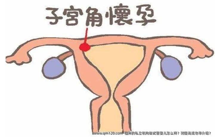 福州的机构做试管婴儿怎么样？附提高成功率介绍？