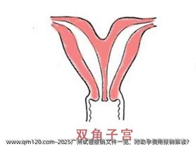 2025广州试管报销文件一览，附助孕费用报销解读？
