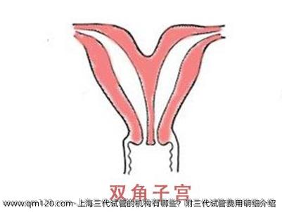 上海三代试管的机构有哪些？附三代试管费用明细介绍
