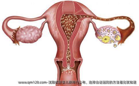 沈阳试管婴儿费用已公布，选择合适医院的方法看完就知道