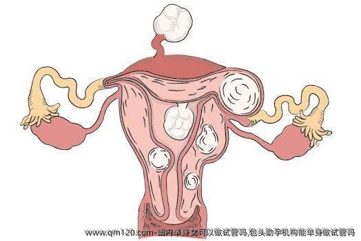 国内单身女可以做试管吗,包头助孕机构能单身做试管吗