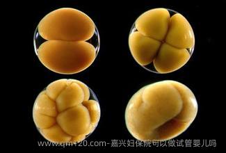 嘉兴妇保院可以做试管婴儿吗？