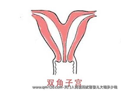 天门人民医院试管婴儿大概多少钱 