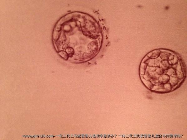 一代二代三代试管婴儿成功率差多少？一代二代三代试管婴儿适合不同需求吗？