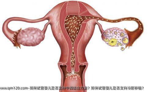 郑州试管婴儿是否支持中西结合方案？郑州试管婴儿是否支持冷胚移植？