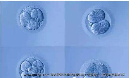 做试管需要得有结婚证吗？试管婴儿一定要有结婚证吗？