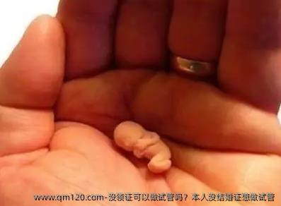 没领证可以做试管吗？本人没结婚证想做试管