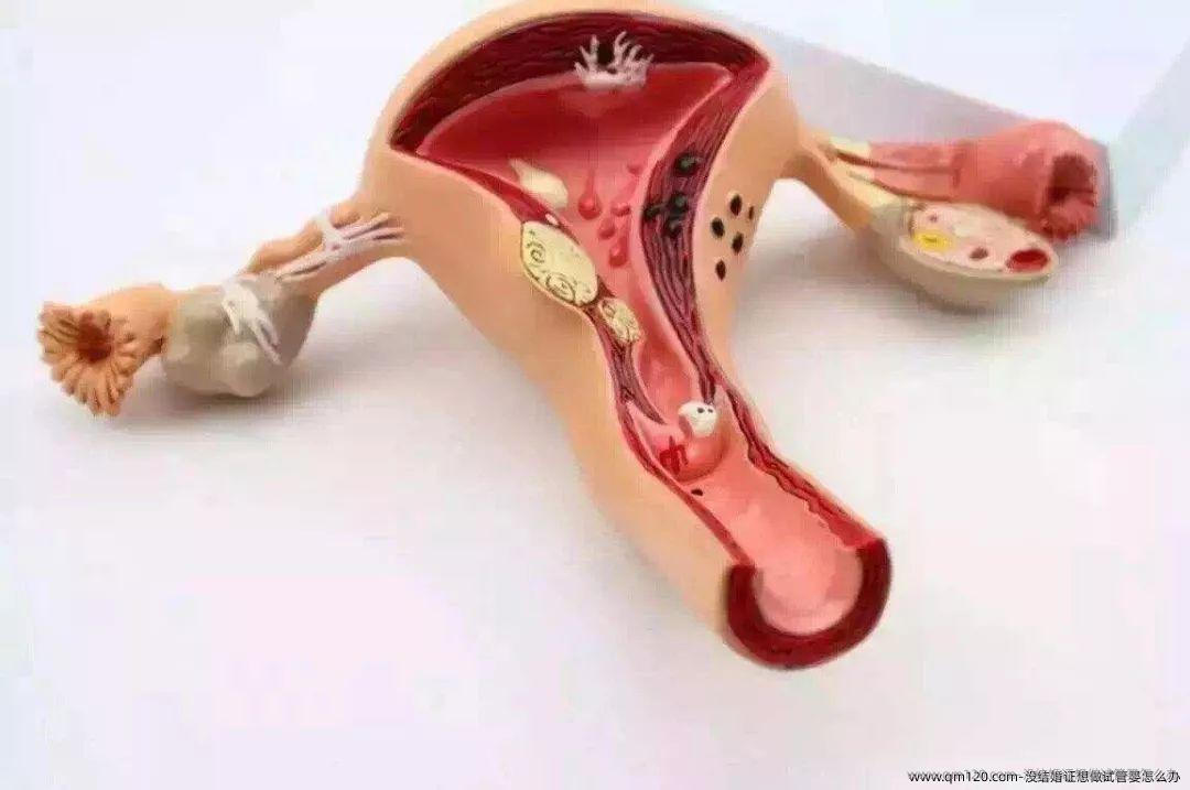 没结婚证想做试管婴怎么办