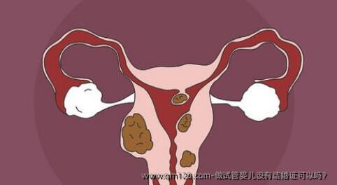 做试管婴儿没有结婚证可以吗？