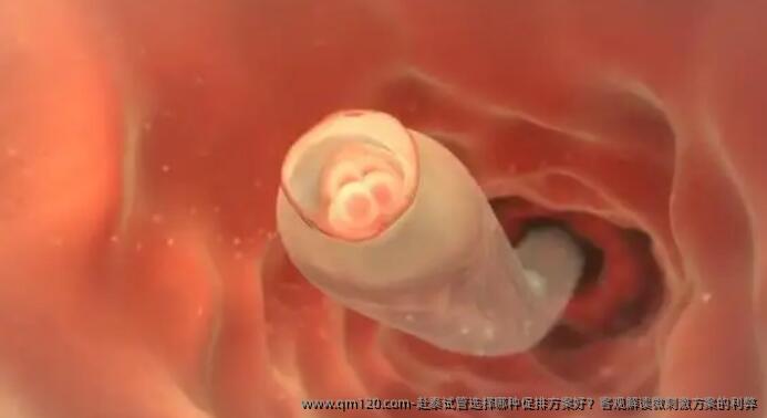 赴泰试管选择哪种促排方案好?客观解读微刺激方案的利弊